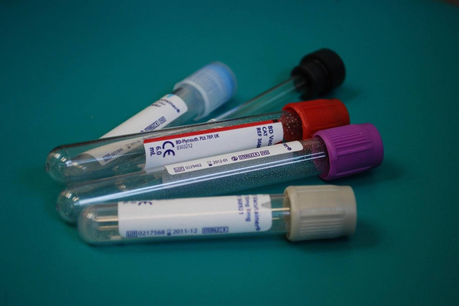 Quiz czy cierpisz na depresję i jak rozpoznać objawy?